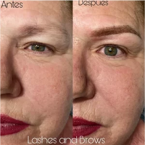 tratamiento de cejas