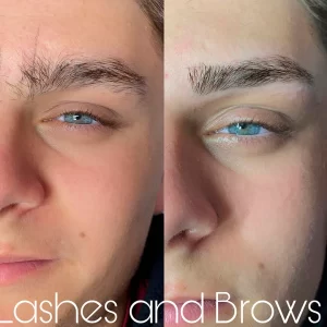 tratameinto de cejas